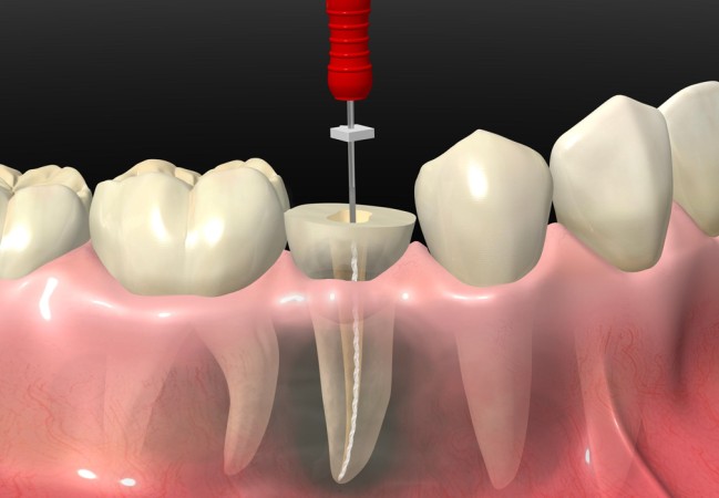Imagen principal del servicio