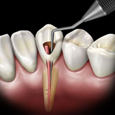 Imagen principal del servicio
