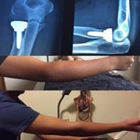 Imagen 6 de servicio