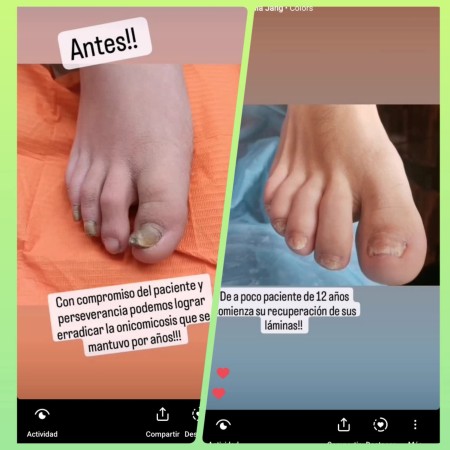 Imagen 0