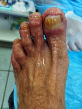 Imagen 5 de servicio
