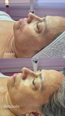 Imagen 5 de servicio