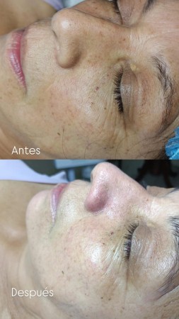 Imagen 7 de servicio