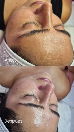 Imagen 8 de servicio