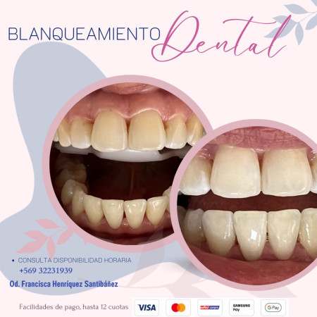 Imagen 3 de servicio