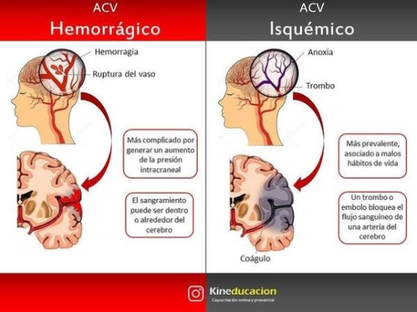 Imagen 3 de servicio