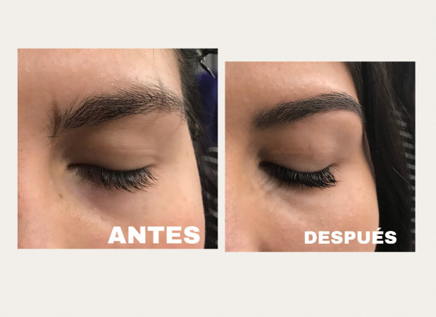 Imagen 8 de servicio