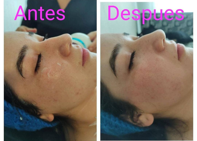 Imagen 2