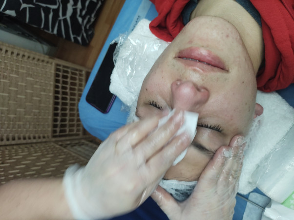 Imagen 23 de servicio