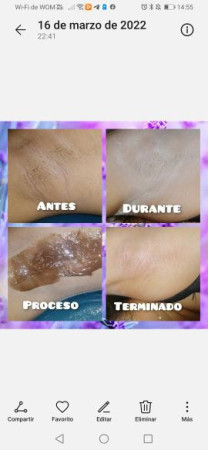 Imagen 3 de servicio