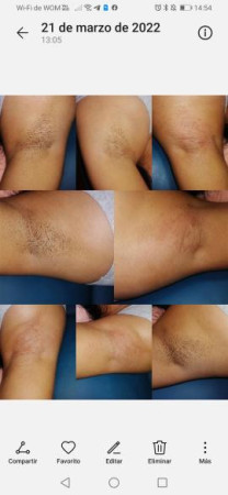 Imagen 4 de servicio