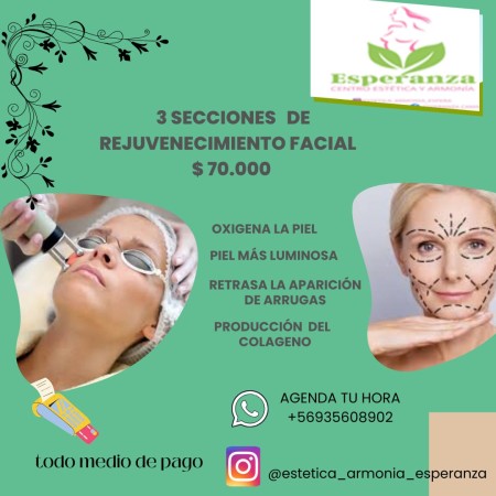 Imagen 4 de servicio