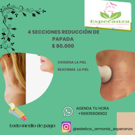 Imagen 2
