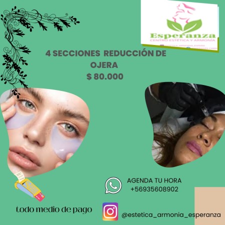 Imagen 7 de servicio