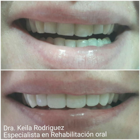 Imagen 7 de servicio