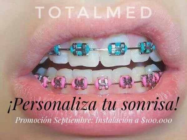 Imagen 2