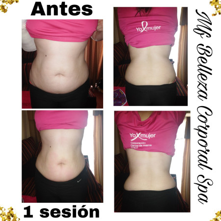 Imagen 4 de servicio