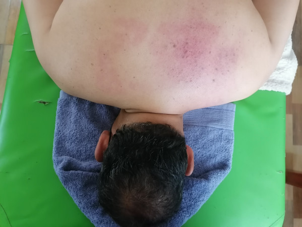 Imagen 9 de servicio