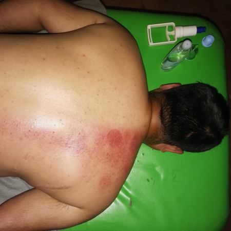 Imagen 10 de servicio
