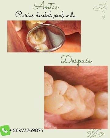 Imagen 2