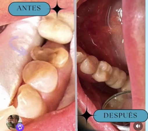 Imagen 3 de servicio