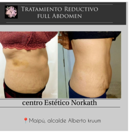 Imagen 3 de servicio