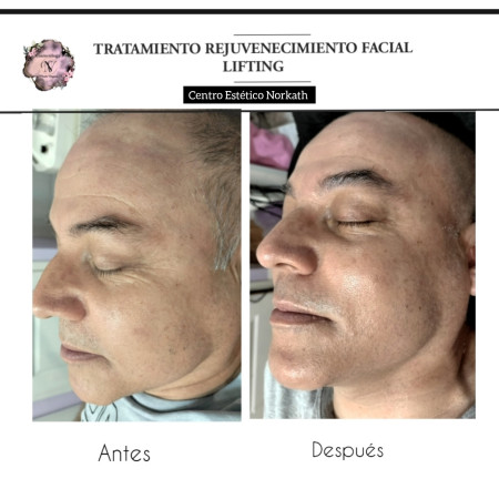 Imagen 4 de servicio