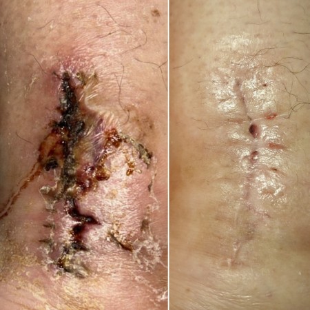 Imagen 3 de servicio