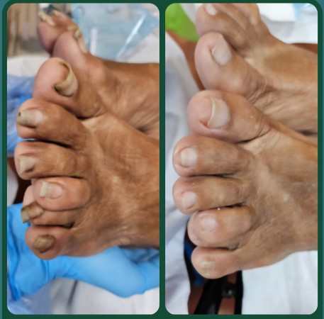 Imagen 3 de servicio