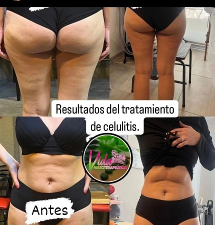 Imagen principal del servicio