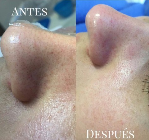 Imagen 3 de servicio
