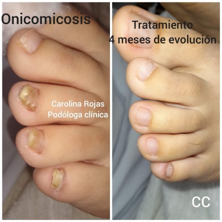 Imagen 3 de servicio