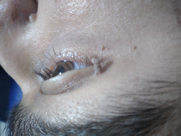 Imagen 2
