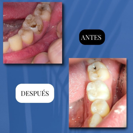 Imagen 2