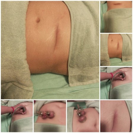 Imagen 3 de servicio