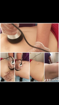 Imagen 21 de servicio