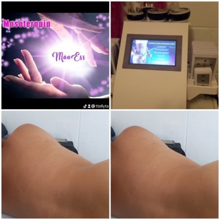 Imagen 31 de servicio