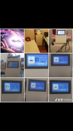Imagen 34 de servicio