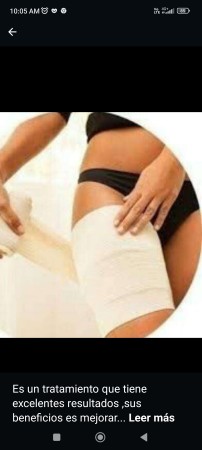 Imagen 43 de servicio