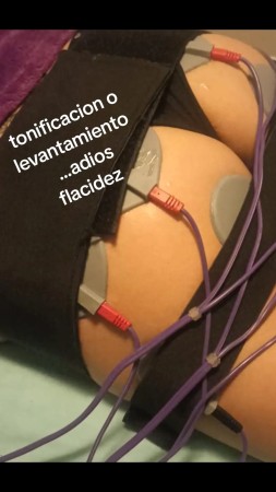 Imagen 89 de servicio